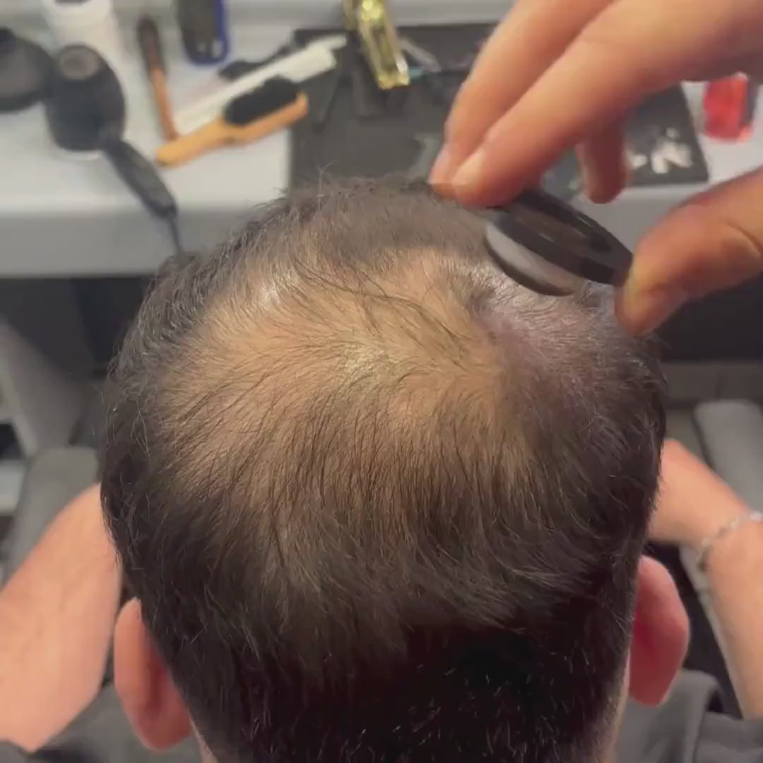 Hair Density Filler